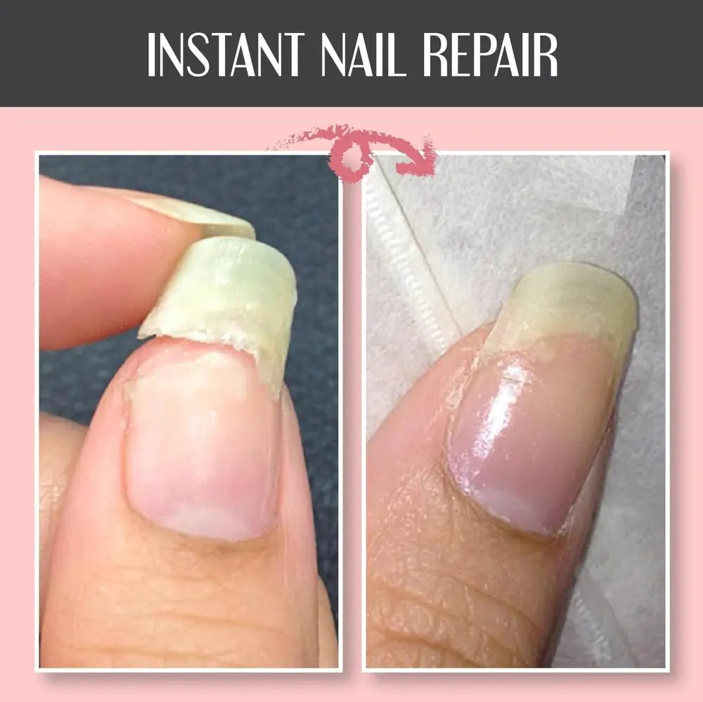 Nail Repair Schutzgel – stärkende Pflege für die Nägel Zorenza